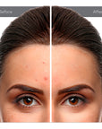 Corrector Líquido All Day Coverage Concealer | 12 Tonos - Ruby Kisses
